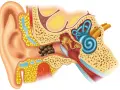 Coupe de l'oreille montrant un bouchon de cérumen dans le conduit auditif, potentiellement cause de vertiges.