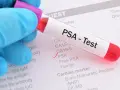 Rękawiczka w niebieskiej rękawiczce trzyma probówkę z krwią do testu PSA. Na formularzu zaznaczono PSA.