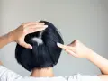 Eine Frau entdeckt kreisrunden Haarausfall am Hinterkopf. Ihre Hände berühren die kahle Stelle, die sich deutlich vom dunklen Haar abhebt.