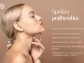 Kobieta po zabiegu lipolizy podbródka. Widoczna poprawa konturu żuchwy, redukcja drugiego podbródka i smuklejsza dolna część twarzy.
