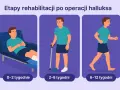 Etapy rehabilitacji po operacji haluksów: odpoczynek (0-2 tyg.), z kulą (2-6 tyg.), chodzenie (6-12 tyg.).