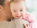 Ein lächelndes, leichtes Down-Syndrom Baby wird von seiner Mutter gehalten.