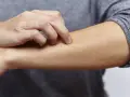 Juckende Haut am Arm, ein mögliches Symptom bei zu viel Zink.