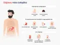 Objawy raka żołądka: utrata masy ciała, czarne stolce, niestrawność, nudności, ból pleców, trudności w połykaniu.