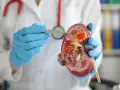 Urolog od czego jest? Objawy, choroby, wizyta i profilaktyka