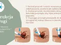 Instrukcja usuwania kleszczy za pomocą przyrządu Trix™. Kleszcze samozaciskowe są łatwe do usunięcia.