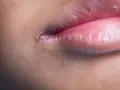 Labbra bianche e screpolate, con piccole pellicine che si staccano. Un piccolo taglio vicino all'angolo della bocca.