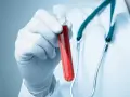 Rękawiczka z pipetą trzyma probówkę z czerwoną cieczą. Lekarz w białym kitlu i zielonym stetoskopie. Co to aptt?