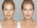 Before and after of a woman's face. The left side shows signs you are aging poorly: wrinkles, sun spots, and uneven skin tone. The right side shows a smoother, brighter complexion.