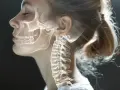 Prześwietlony profil kobiety z widocznym szkieletem głowy i kręgosłupem szyjnym. Zwraca uwagę nienaturalne wygięcie kręgów, przypominające wdowi garb.