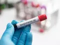 Ręka w niebieskiej rękawiczce trzyma probówkę z etykietą "lipoproteina (a)". Badanie poziomu tej lipoproteiny jest ważne.