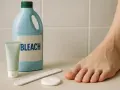 Pied sain, tube de crème, lime et flacon de javel. Un traitement efficace contre la mycose de l'ongle du pied.
