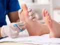 Badanie neurologiczne stopy, sprawdzanie odruchu Babińskiego za pomocą młoteczka.