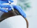 Botox na włosy przed czy po farbowaniu - uniknij osłabienia koloru