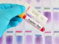 Rękawiczka trzyma probówkę z krwią i test H. pylori. Czasem objawy psychiczne mogą być związane z tą infekcją.