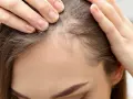 Dłonie kobiety dotykają jej czoła, sprawdzając delikatne baby hair przy linii włosów.