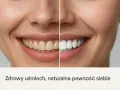 Uśmiech przed i po wybielaniu. Unikaj nie mycia zębów na noc, by cieszyć się bielą.