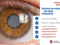 Zaćma wrodzona u dziecka: Objawy, diagnoza, leczenie ratuj wzrok!