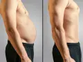 Antes y después: abdomen con grasa y abdomen tonificado. Un cambio radical para eliminar grasa abdominal.