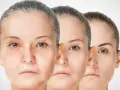 Trois visages de femmes montrant le processus de régénération de la peau, du plus âgé au plus jeune.