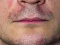 Schuppige Gesichtshaut Make-up: So vermeiden Sie trockene Flecken
