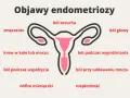 Objawy endometriozy: ból brzucha, zmęczenie, krew w kale/moczu, ból podczas współżycia, obfite miesiączki, ból głowy, ból podczas wypróżniania, ból przy oddawaniu moczu, niepłodność.