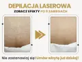Depilacja laserowa bikini przed i po: widoczna redukcja owłosienia po 9 zabiegach. Gładka skóra bez podrażnień.