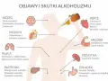 Ilustracja pokazuje skutki alkoholizmu, m.in. problemy z mózgiem, sercem, wątrobą, płucami, żołądkiem, trzustką i mięśniami, zgodne z klasyfikacją ICD 10.