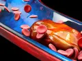 Rote Blutkörperchen umgeben einen großen Thrombus in einem Blutgefäß. Der Thrombus behindert den normalen Blutfluss und kann den Puls beeinflussen.