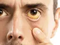 Zespół Gilberta: objawy psychiczne – czy to w Twojej głowie?