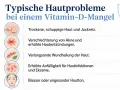 Problemi tipici della pelle con carenza di vitamina D: pelle secca, acne, lenta guarigione, infezioni e colorito spento.