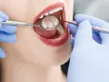 Ile kosztuje wizyta u dentysty bez ubezpieczenia? Sprawdź ceny!