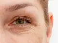 Nahaufnahme eines Auges mit deutlichen Lachfalten. Die Falten im Gesicht erzählen Geschichten von gelebtem Leben.