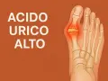Dito, cristalli di acido urico si accumulano nell'articolazione dell'alluce, causando infiammazione e dolore.