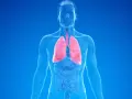 Menschlicher Torso mit roten Lungen, die auf COPD und die Notwendigkeit einer Pflegestufe hinweisen.