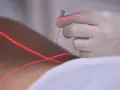 Eine Hand in einem Handschuh führt eine prt spritze unter rotem Laserlicht.