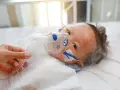 Dziecko z maską tlenową, być może z powodu RSV. Co to jest RSV? To wirus, który może być groźny dla najmłodszych.