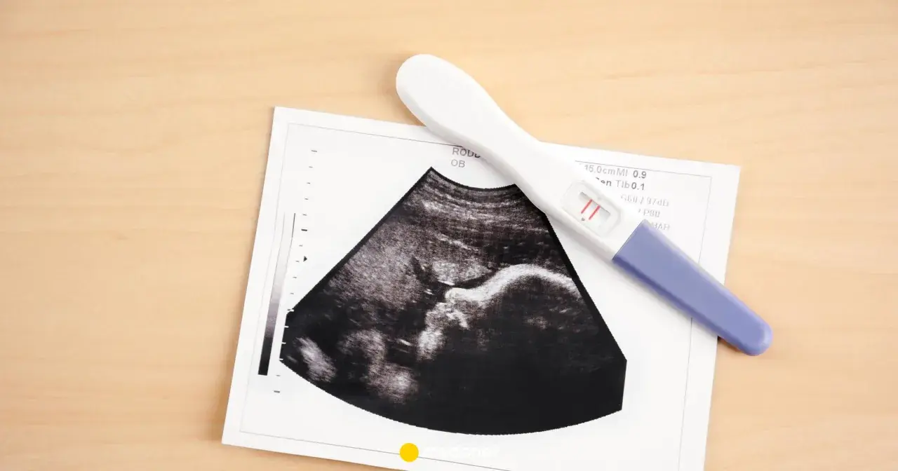 USG pokazuje pęcherzyk ciążowy, a obok leży pozytywny test ciążowy.