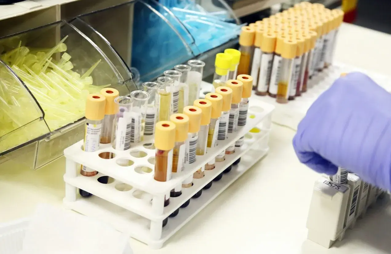 Probówki z próbkami krwi w laboratorium, ręka w rękawiczce pobiera jedną z nich.