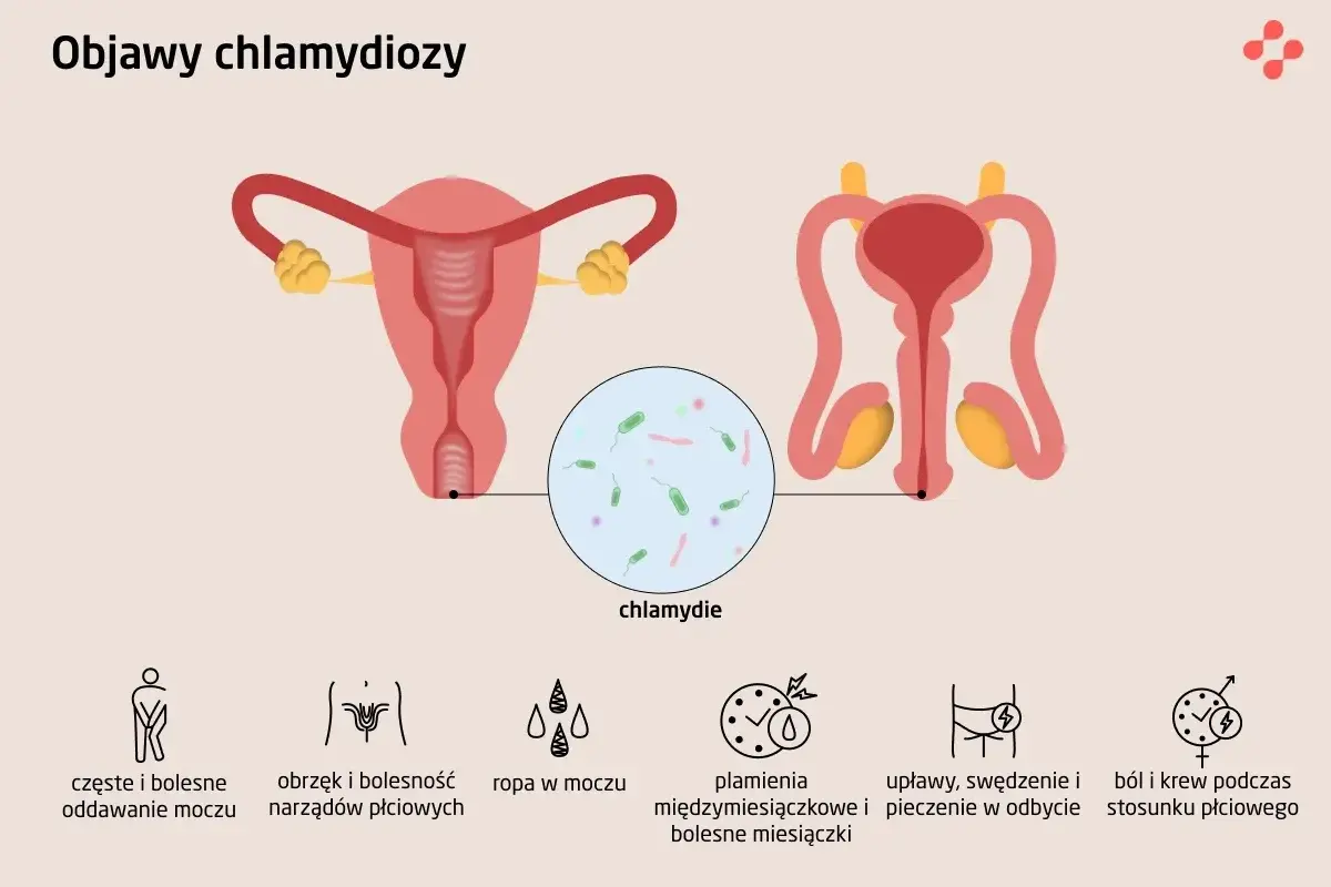 Ilustracja przedstawia układ rozrodczy kobiety i mężczyzny, z powiększeniem ukazującym bakterie chlamydii. Wymienione objawy chlamydiozy to m.in. ból przy oddawaniu moczu i plamienia.