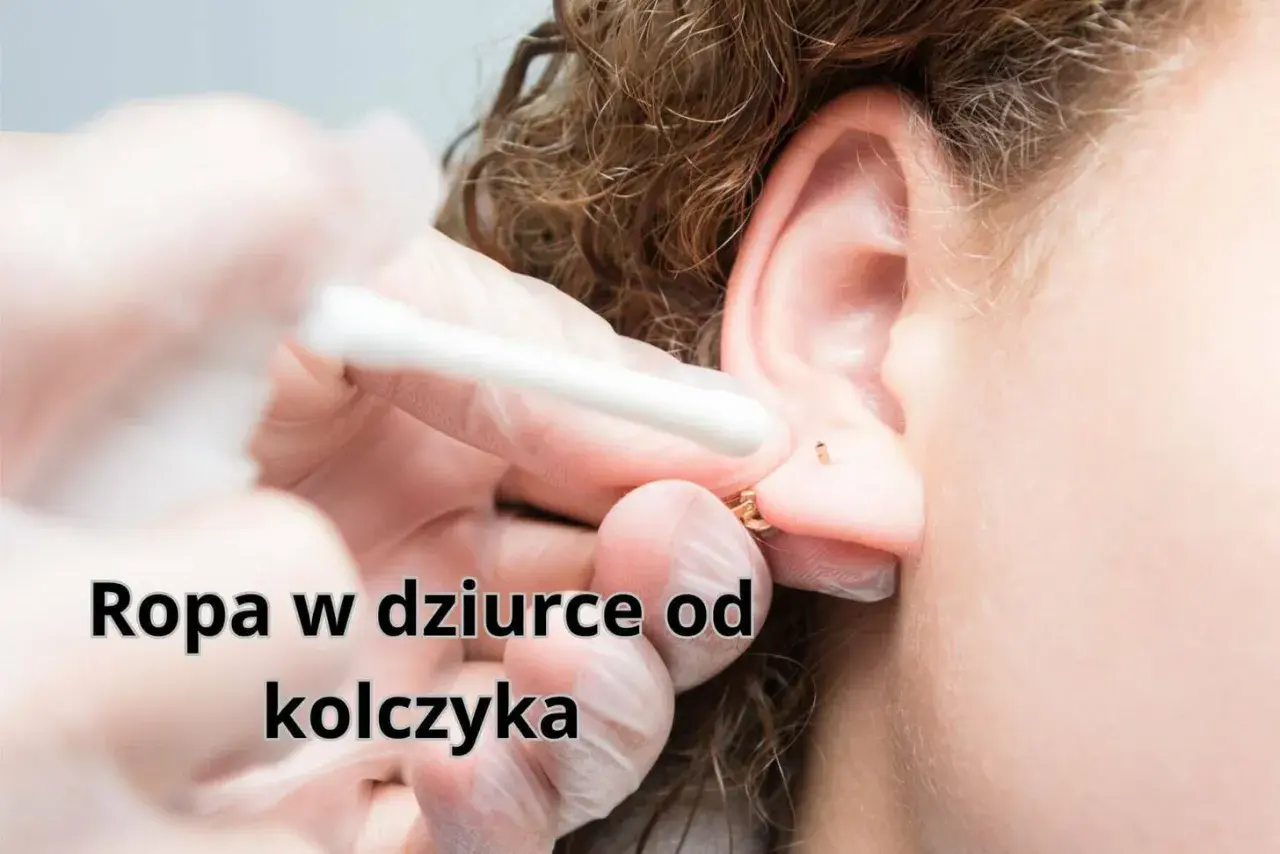 Ropa w dziurce od kolczyka, widoczna podczas czyszczenia ucha wacikiem.