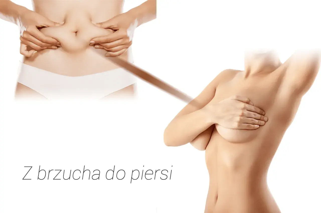 Przed i po: powiększenie biustu własnym tłuszczem opinie. Z brzucha do piersi.