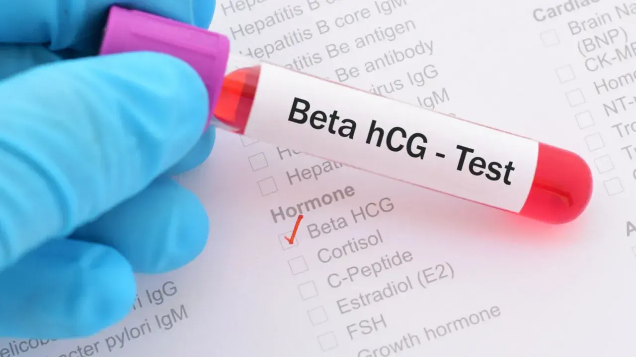 Rękawiczka w niebieskiej rękawiczce trzyma probówkę z krwią do testu Beta hCG. Na formularzu zaznaczono "Beta HCG" w sekcji "Hormone".