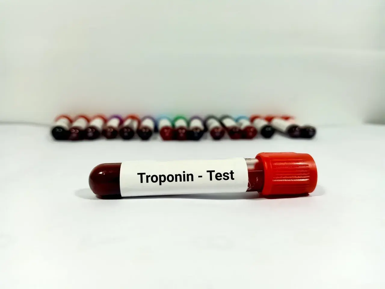 Probówka z oznaczeniem "Troponin - Test" na tle rzędu innych próbek krwi.