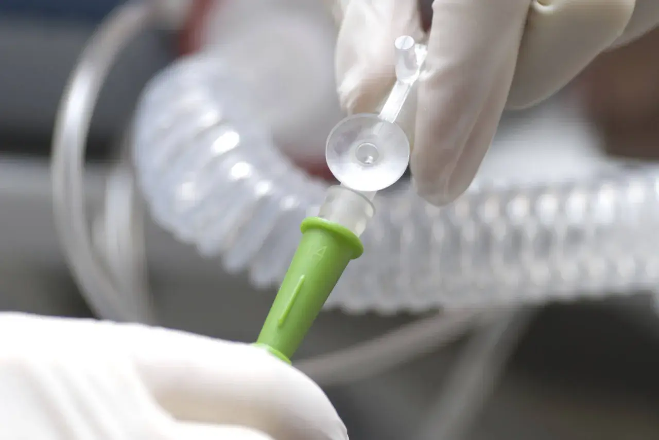 Hände in Handschuhen verbinden ein medizinisches Schlauchsystem. Mögliche Nachteile einer PEG-Sonde sind Infektionen und Verstopfungen.