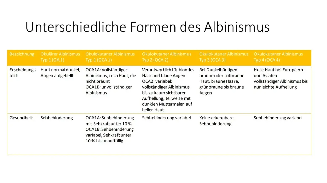 Tabelle zeigt verschiedene Formen von Albinismus bei Menschen, von vollständigem bis zu leichter Aufhellung, mit Auswirkungen auf Haut, Haar und Augen.