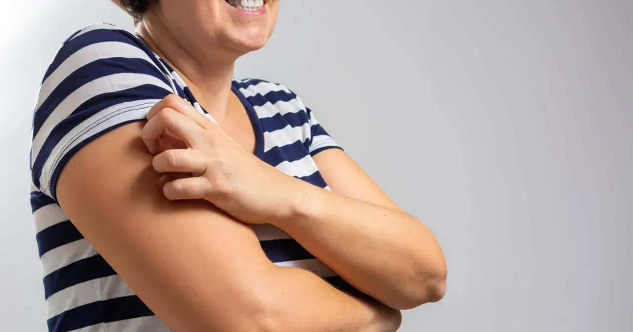 Kobieta w pasiastym T-shircie drapie się po ramieniu, doświadczając bardzo nietypowe objawy menopauzy, takie jak swędzenie skóry.