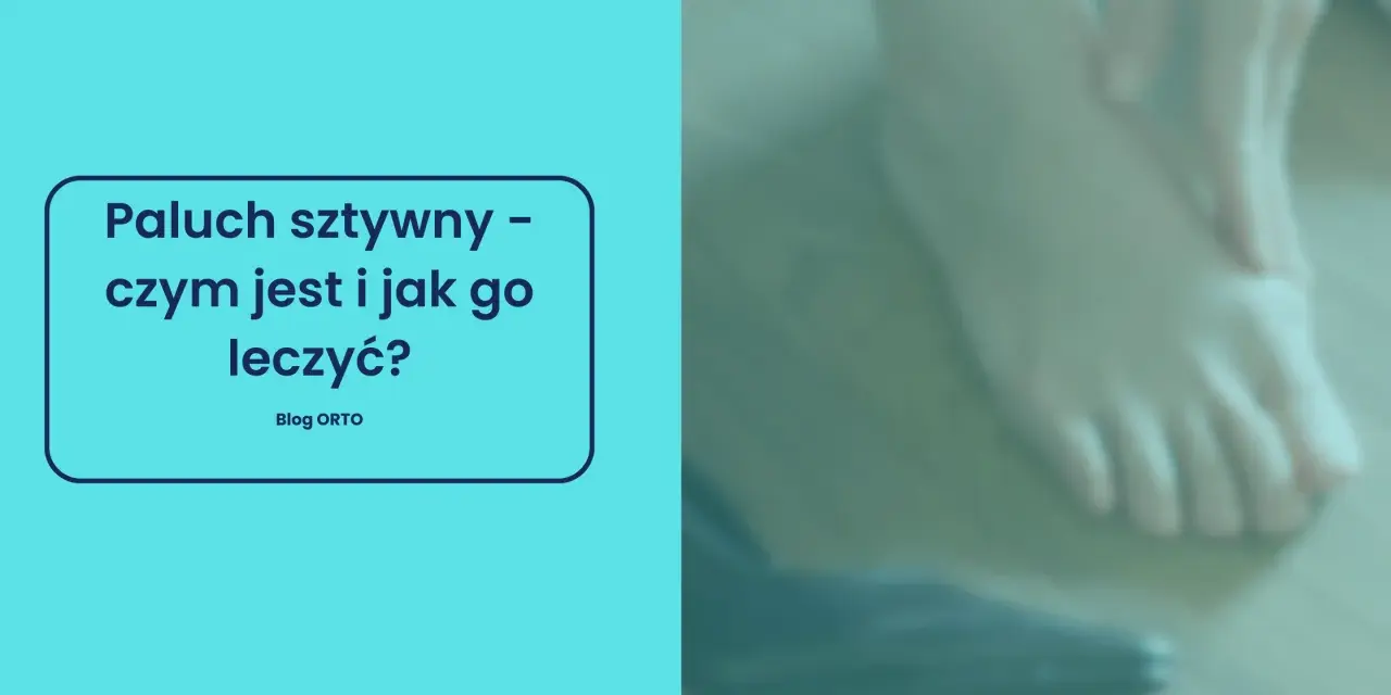 Paluch sztywny – co to za schorzenie i jak sobie z nim radzić? Na zdjęciu widać stopę, która może cierpieć z powodu tej dolegliwości.