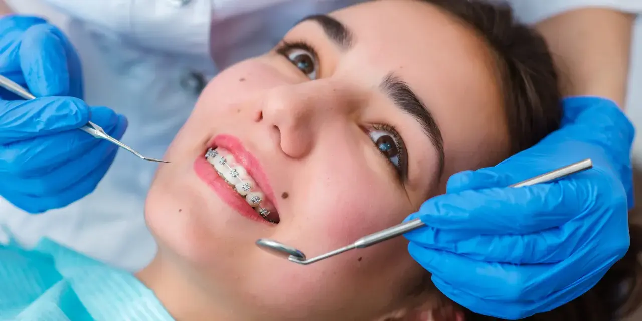 Młoda kobieta z aparatem ortodontycznym na zębach podczas wizyty u ortodonty. Dentysta w niebieskich rękawiczkach bada jej uśmiech.