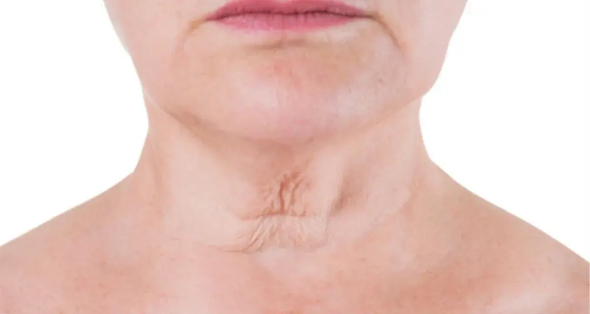 Primer plano del cuello de una mujer, mostrando arrugas en el cuello y la piel con pecas.